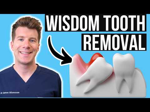 Doctor explains Wisdom Tooth Removal