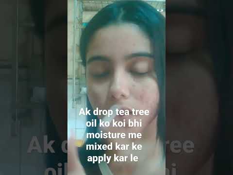 how to use tea tree oil ance pro skin#shorts #shortsindia #youtubeshorts #shortsvideo #skincare