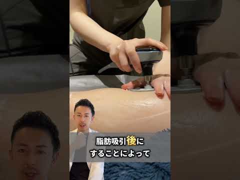 【解説】医療用インディバの効果とは？