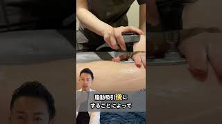 【解説】医療用インディバの効果とは？