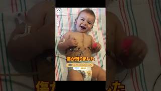 孫の傷を腕に刻んだおじいさん | 感動する動画