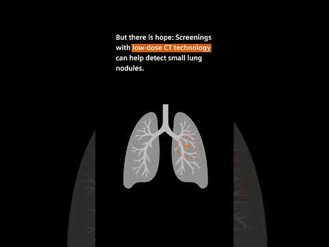 Lung cancer: Catch it while it‘s small