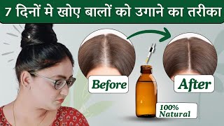 World Best hair oil Tripple Fast hair growth : 7 दिनों मे खोए बालों को उगाने का आसान तरीका।