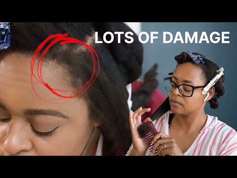 Is Your 4C Hair DAMAGED? How to Tell + Fix It