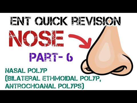 Dr. Deen's Insights on Nasal Polyps: Ethmoidal and Antrochoanal Types