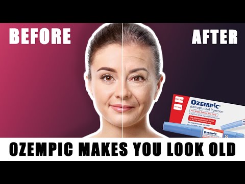 Why Doctor Says Ozempic Face is a Problem: What You Need to Know!