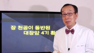 [암치료 전략 Q&A] 장 천공이 동반된 대장암 4기인데 항암치료와 함께 가능한 모든 치료를 하고 싶어요 - 류영석 원장