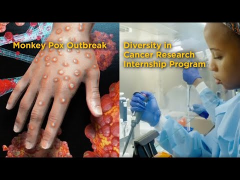 Monkey Pox Outbreak & Diversity in Cancer Research Internship Program-Front Line News Aug 26, 2022