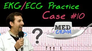 12 Lead ECG Practice Strip Interpretation - EKG Case 10