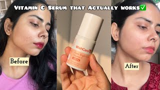 Detailed review of new launch WishCare Super Bright C16 Vitamin C serum | After trying for 1 month