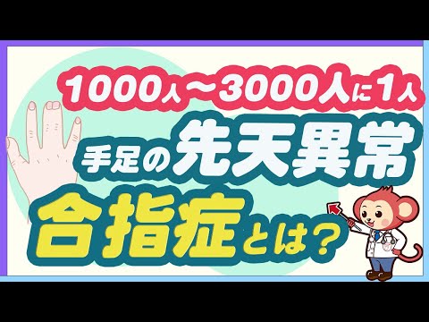 【意外と多い】手足の先天性異常の合指症を医師監修で詳しく解説