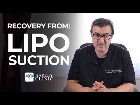 How Long Does Recovery Take For Liposuction? | Liposuction Surgery Recovery Guide