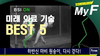 [미래 랭킹쇼] 미래 의료기술 BEST 5 (미래예보 on tomatoTV) #미래채널 #마이에프 #myf