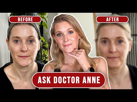 Ultimate Beginners Guide on How To Self Tan: Tips plus Coco and Eve Review! Doctor Anne