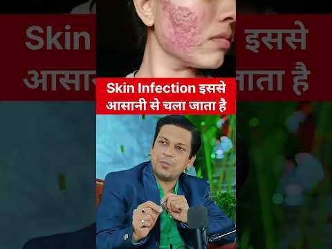 Skin infection ke liye ye karein #ankurnandanofficial