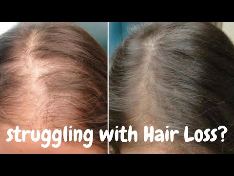 20% Actives Peptide Stem Cell Hair Growth Serum | The Derma Co | How to reduce Hair Fall