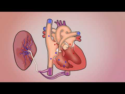 Tetralogy - Fetal w/Bloodflow