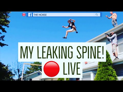 My spine is leaking on Facebook Live!